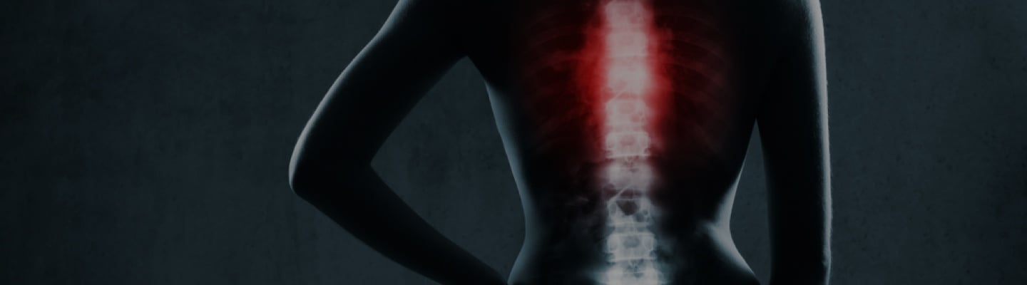 xray of spinal injury